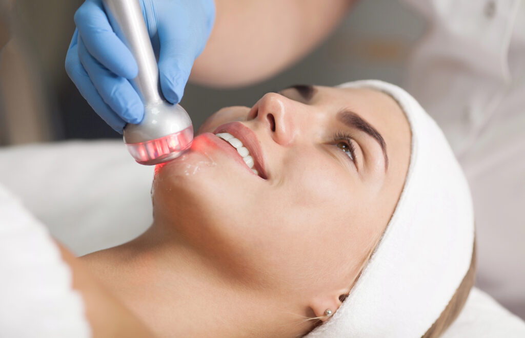 טיפול RF לפנים