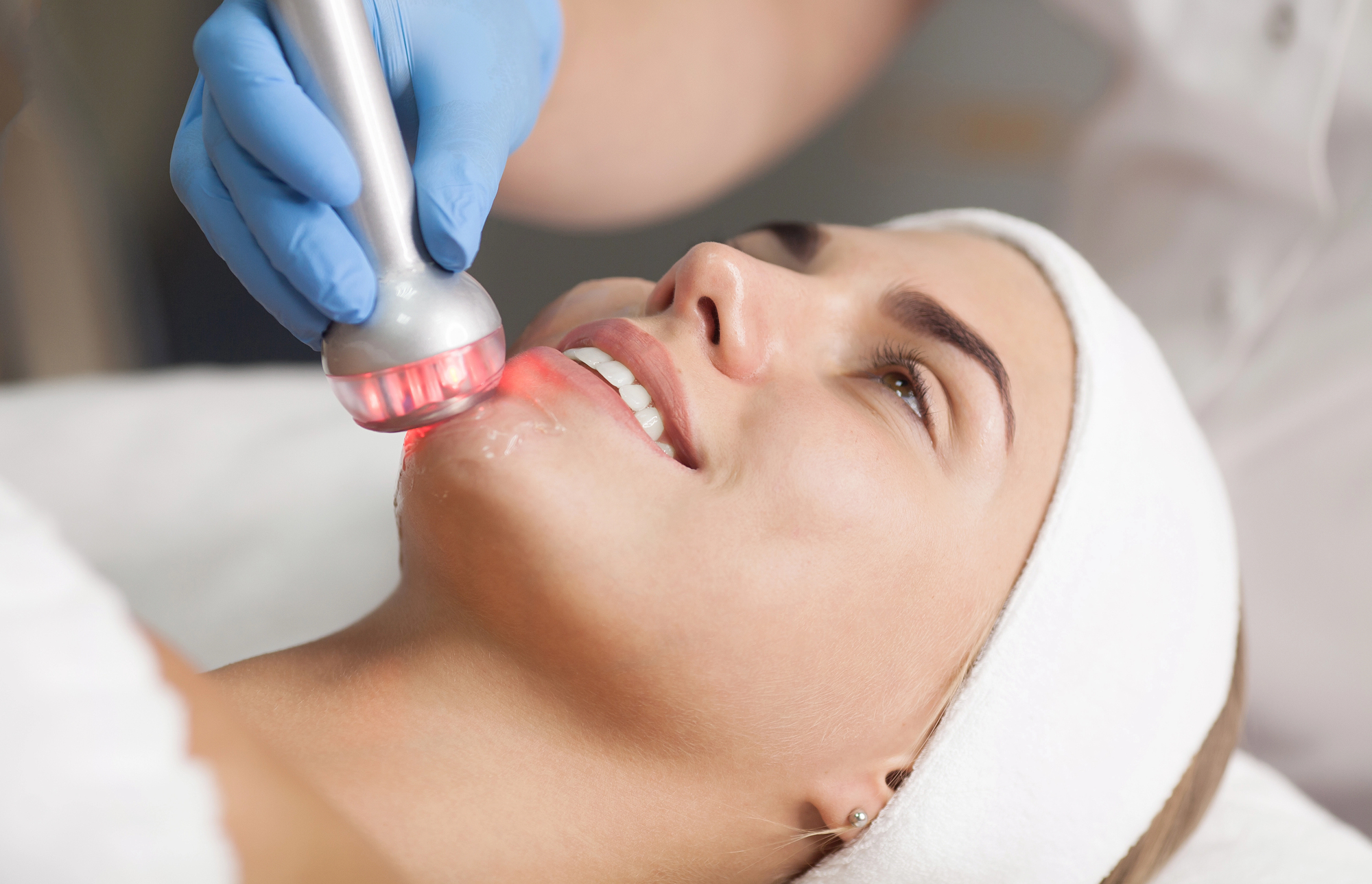 טיפול RF לפנים